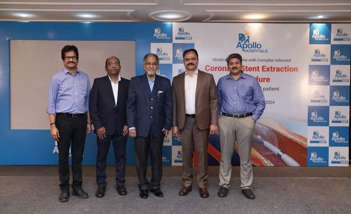 Apollo OMR Hospital Executes Complex Stent Extraction